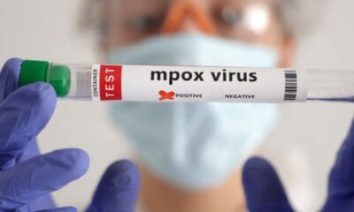 OMS convoca comitê para reavaliar emergência global por mpox